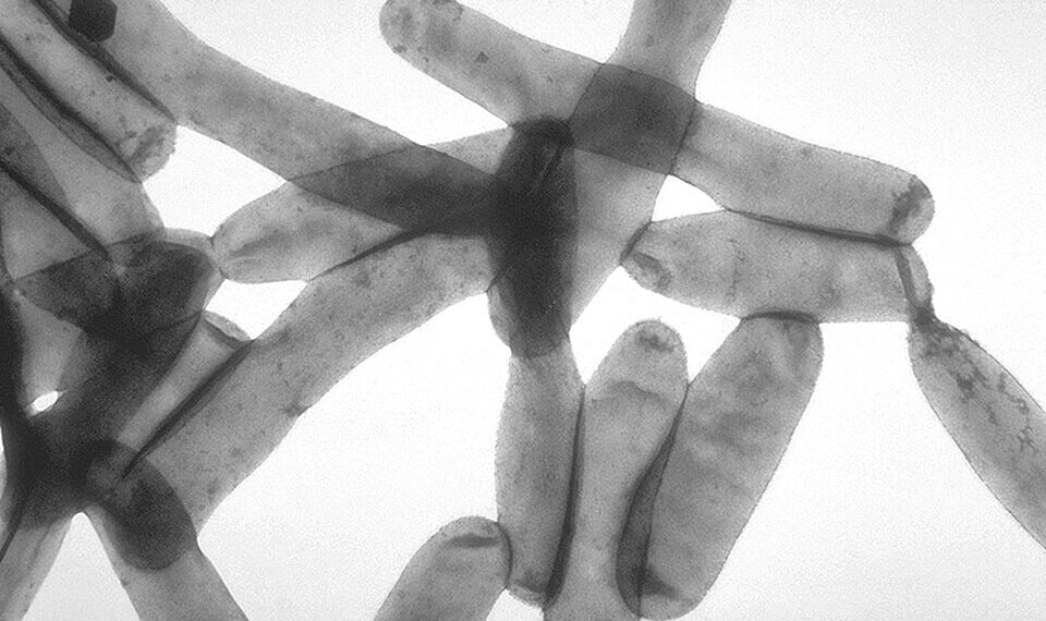 UWS Building’s Hot Water System Tests Positive for Legionella Bacteria, Memo Shows