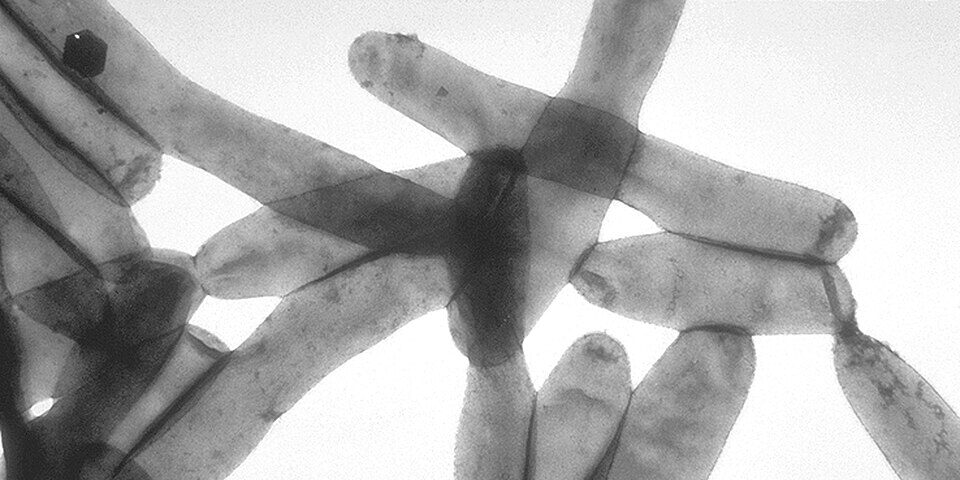 UWS Building’s Hot Water System Tests Positive for Legionella Bacteria, Memo Shows - West Side Rag